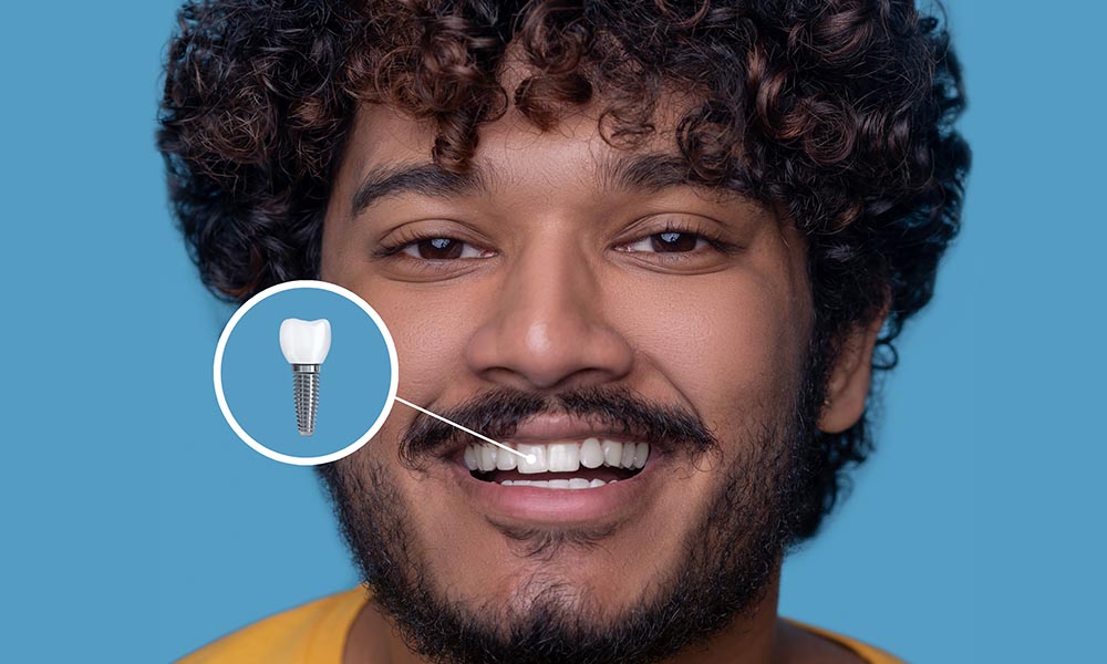 Dental implant Perth