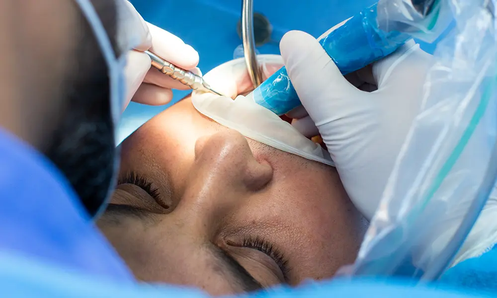 Root canal Perth