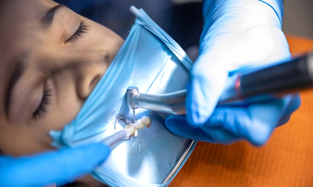 what is a root canal