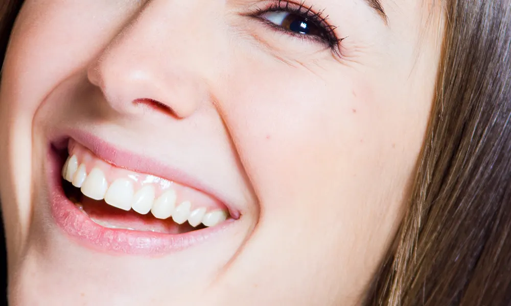 gummy smile treatment perth